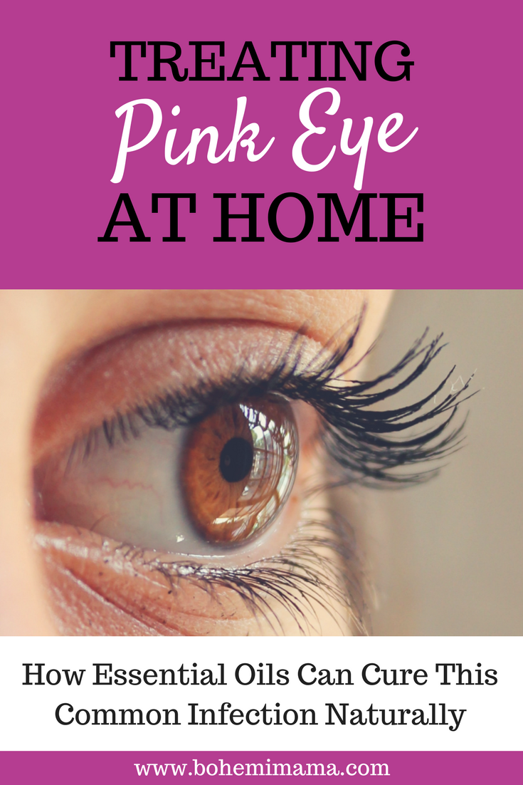 Treating Pink Eye At Home | Pink eye is a very common eye infection which sometimes results in antibiotics and eye creams. Learn how to treat it naturally using one simple essential oil. Click the image to learn more.